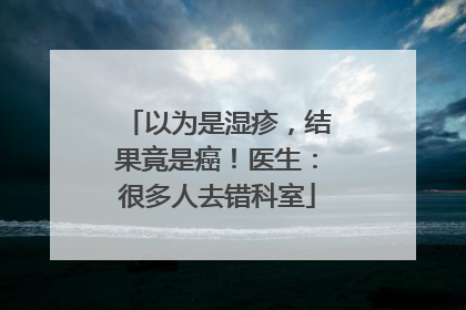 以为是湿疹，结果竟是癌！医生：很多人去错科室